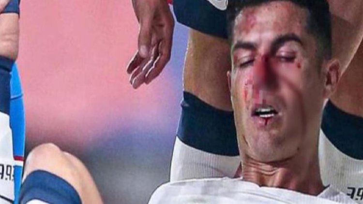 Savaştan çıkmış gibi görünüyor! İşte kanlar içinde yerde kalan Ronaldo’nun son hali